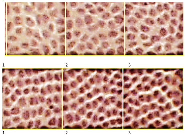 Epithelial cells bounded by ocular mesh squares:1,2. 3 - Poorly differentiated cells; 4,5,6-highly differentiated cells; MI and micronuclei were detected in the germinal zone (2) and in the preequatorial zone (5)
