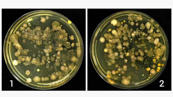 Presentation collage of kolonium on petri dishes with Heart agar, microbiological inoculation 10x dilution period and incubation-7 days (1; 2)