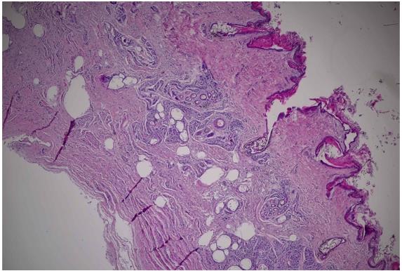 The microphotographs of the male specimen of the inguinal gland. The general view of the
       inguinal gland’s structure and the composition of tissue