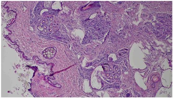 The microphotographs of the male specimen of the inguinal gland. The view of the branched
structure of the sebaceous glands, its’ excretory ducts, the secret that concentrates in the
ducts, the hair sheath and excretes out of the hair follicles