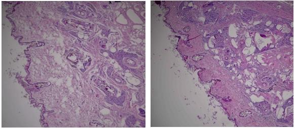 The microphotographs of the inguinal glands’ cross-section: the left photo – the female
specimen, the right photo – the male specimen