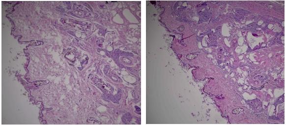 The microphotographs of the inguinal glands’ cross-section: the left photo – the female
       specimen, the right photo – the male specimen