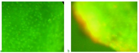 Marginal region of the caudal fin blastema of zebrafish fed with "Chigyany ROZ" food, when stained for the distribution of DNA and RNA (DNA-green fluorescence, RNA-orange and red fluorescence); a – Day 3 of regeneration; b-day 9 of regeneration 