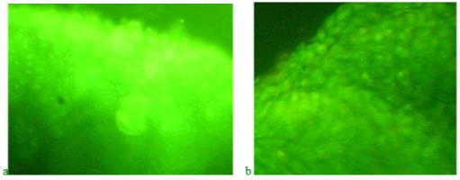 Distribution of nucleic acids in the blastem of the regenerating fin of fish in potassium dichromate solutions: a - 3rd day of regeneration; b-9th day of regeneration 