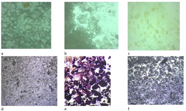 Microstructure of a slurry suspension heated in a thermostat at 50 ° C for 10 minutes with different concentrations of pretreated vegetable powder, colored with iodine: sample a - Jerusalem artichoke, 1.4%; tomato, sample b -apple, carrot, 2.0% and sample c -tomato, paprika, dill. 3.0%. Samples d, e, g with water at a concentration of 1, 2, and 3%. Magnification x40