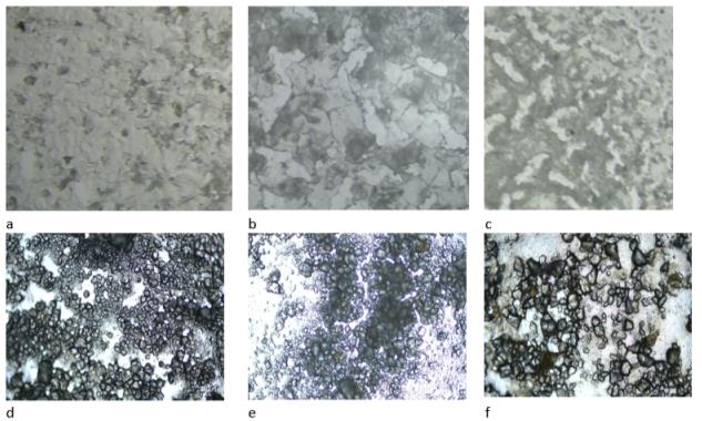 Microstructure of a slurry suspension heated in a thermostat at 100 ° C for 5 minutes with different concentrations of pretreated vegetable powder, colored with iodine: sample a - Jerusalem artichoke, 1.4%; tomato, sample b -apple, carrot, 2.0% and sample c -tomato, paprika, dill. 3.0%. Samples d, e, g with water at a concentration of 1, 2, and 3%. Magnification x40