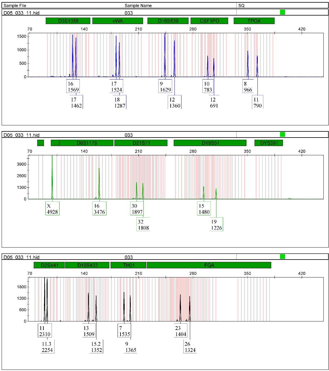 A section of a full STR profile obtained using Globalfiler PCR amplification Kit