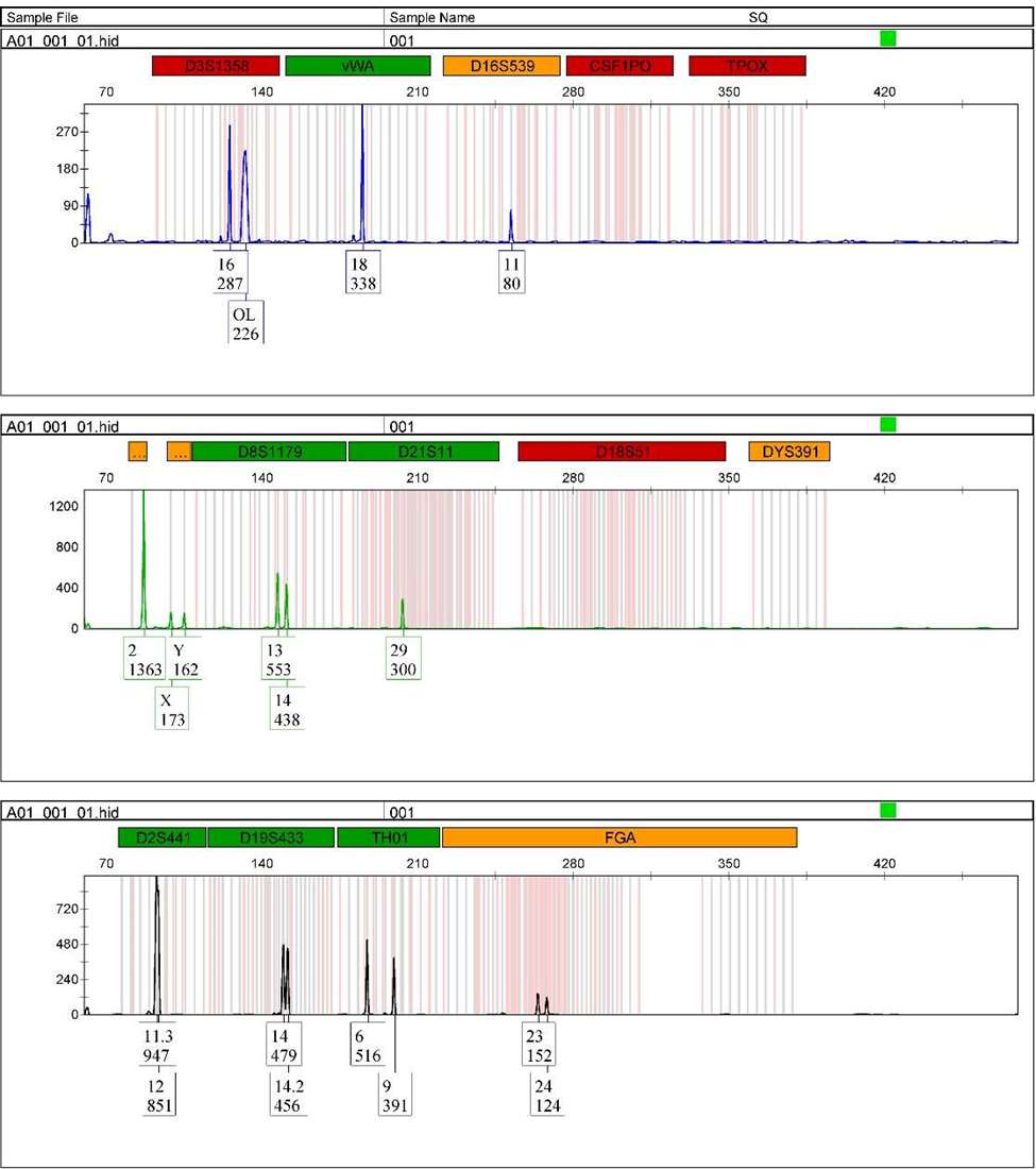 A section of a partial STR profile obtained using Globalfiler PCR amplification kit