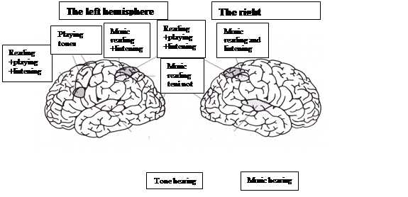 A musician’s brain – the brain’s areas which are active during specific music activities (according to Spitzer (2014))