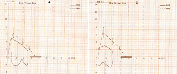 Flow-volume curve: initial testing (A) and final testing (B) – Severe vs. moderate obstruction