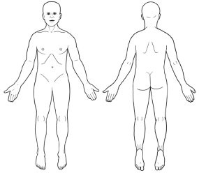 The body area where you feel pain
