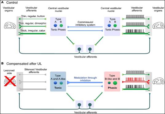 Central vestibular compensation (with permission of Mylan Company)