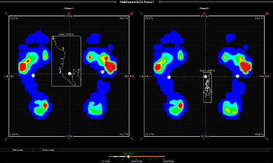 Dr Foot Analysis 4.0 – Plantar surface, plantar footprint, pressure points, together with
      the position of the centre of gravity