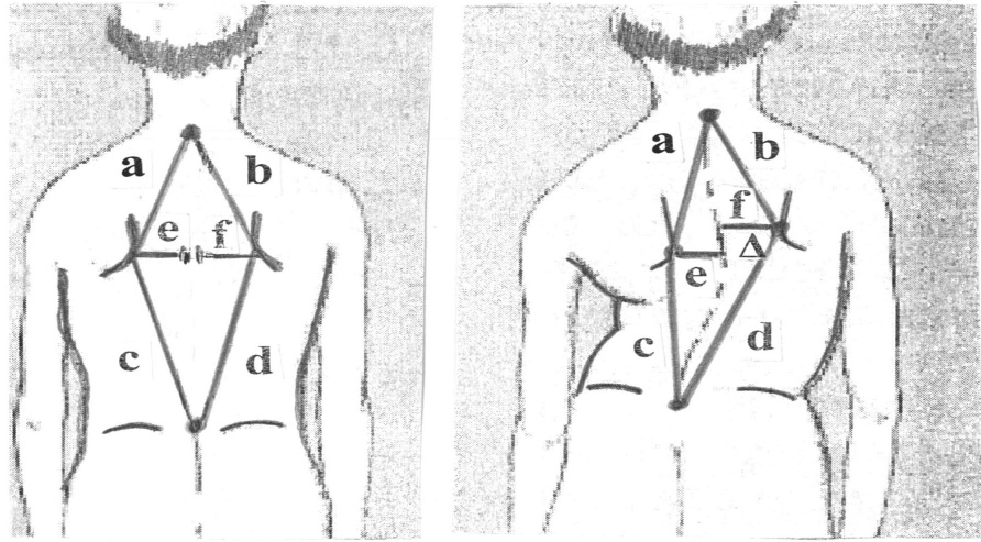 Moshkov's Quadrangle in Norm and Pathology