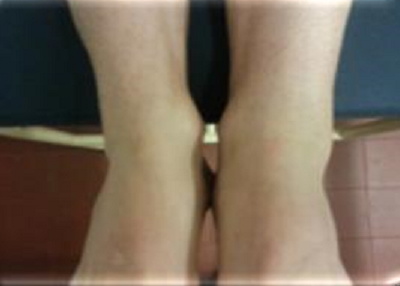 Ankle joint - higher plane, J. B. 