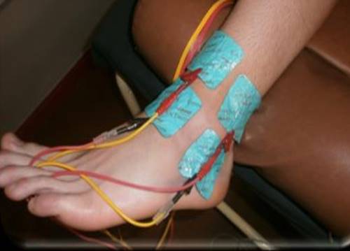 Electrotherapy treatment, J. B.