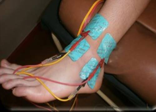 Electrotherapy treatment, J. B. 