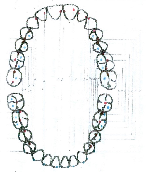 Maximal intercuspidation – selective clinical cases from Dental clinic Based “M. Kogalniceanu” Iași