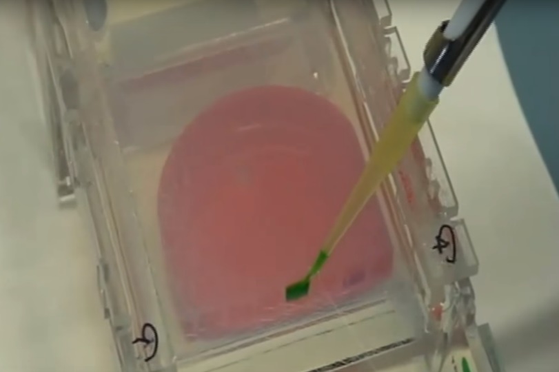 Agarose gel sample-loading process performed as a part of a PCR protocol