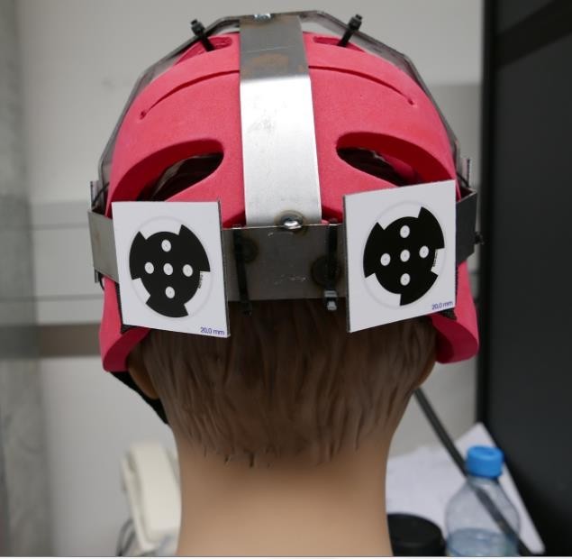 An Image of MXT Markers to attain 3D model