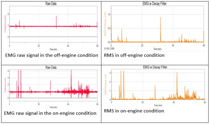 The EMG signal (a) the off-engine condition (b) RMS in off engine condition (c) the on-engine condition (d) RMS in on-engine condition